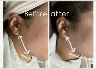 NICOLAUGH/ 村松【小顔.ボディ】のエステ・リラクイメージ