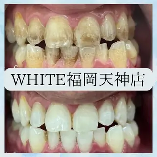 メンズ ホワイトニング専門店 WHITE天神店のエステ・リラクイメージ