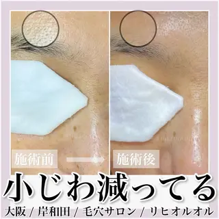 毛穴汚れ改善専門店/ 岸和田/リヒオルオルのエステ・リラクイメージ
