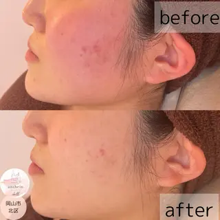 アンテインチル 山本のエステ・リラクイメージ