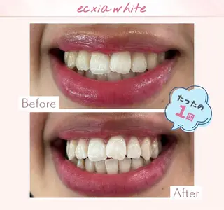 エクシアホワイト調布所属・セルフホワイトニング エクシア調布店のその他イメージ