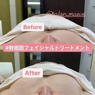 長堀橋エステサロン Maeveのエステ・リラクイメージ