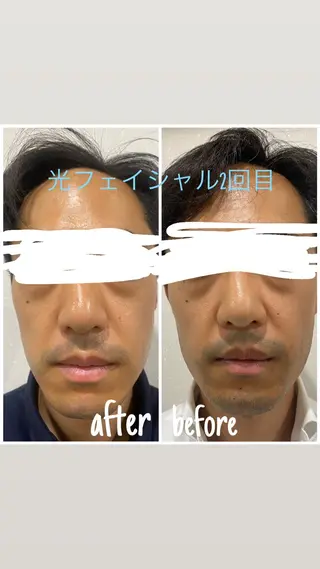 毛穴洗浄・痩身・脱毛 /アルカンジュのエステ・リラクイメージ