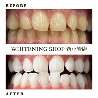 ホワイトニング ショップ新小岩店のその他イメージ
