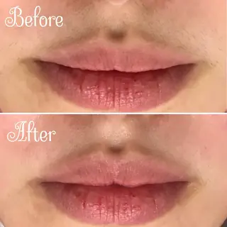 透明感の肌Lino malieのエステ・リラクイメージ