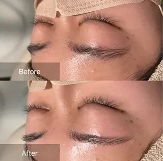 アイブロウ for woman所属・森 美優のエステ・リラクイメージ