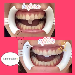 QANAEL所属・QANAEL 小山のエステ・リラクイメージ