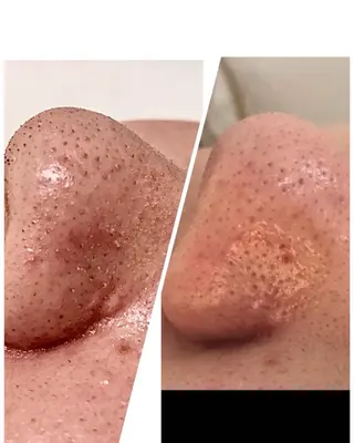 肌質改善 KALANCHOEのエステ・リラクイメージ