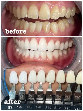 セルフホワイトニング エクシア岡崎店所属・ホワイトニング/脱毛 専門店エクシア岡崎店のその他イメージ