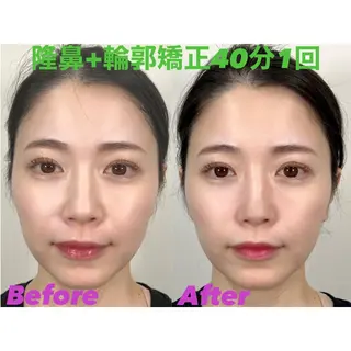 隆鼻矯正専門店ラプリ 佐藤のエステ・リラクイメージ