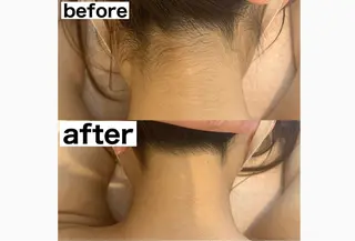 美肌コラーゲン脱毛SINCERITE【サンセリテ】所属・瀬野 のぞみのエステ・リラクイメージ