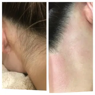 フェイシャル/脱毛 ジョアアンジェ　田中のエステ・リラクイメージ