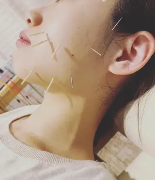 むくみたるみ専門☆ 美容鍼・小顔矯正のエステ・リラクイメージ