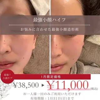 コアラル恵比寿店 chiakiのエステ・リラクイメージ