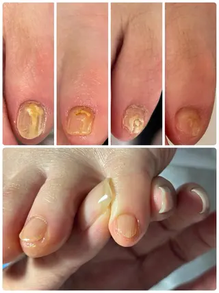 ネイル Alo.nail アロ•ネイルのネイルデザイン