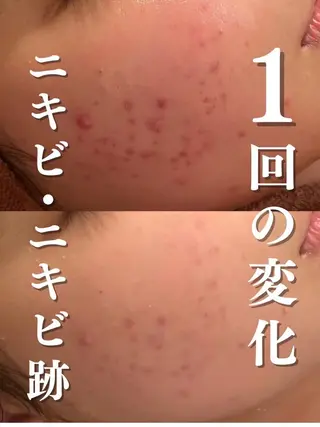 触れたくなる モテ肌へ...❤︎のエステ・リラクイメージ