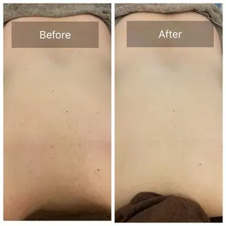hm NATURESKINのエステ・リラクイメージ
