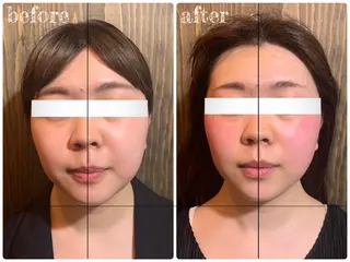 💎後悔させない小顔 矯正💎イトヤマ🌱のエステ・リラクイメージ