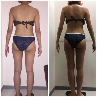 高速脱毛エステ リアンのエステ・リラクイメージ