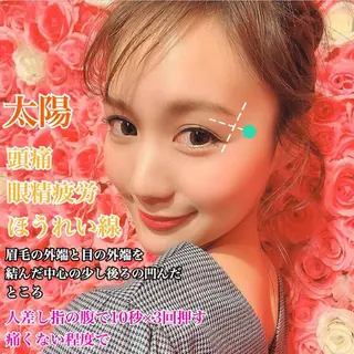 鍼灸整骨院Refine所属・鍼灸 Refineのその他イメージ