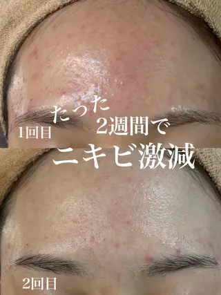 WHITE AQUA 北千住店のエステ・リラクイメージ