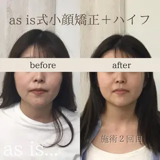 小顔専門アズイズ ビューティー　草津店のエステ・リラクイメージ