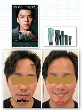 YUI🤍肌悩みに ＊速攻透明感！のエステ・リラクイメージ