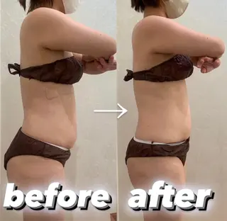 BeauL銀座 村浜友菜🤍のエステ・リラクイメージ