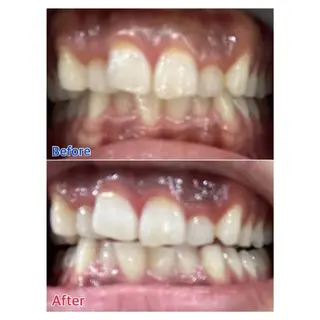 MBEAUTYSALON 千葉店・京成大久保所属・Melty 輝のその他イメージ