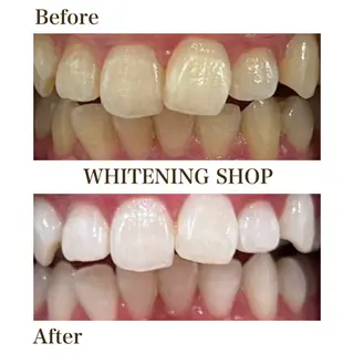 メンズ ホワイトニングショップ静岡葵区店所属・ホワイトニング ショップ静岡葵区店のその他イメージ