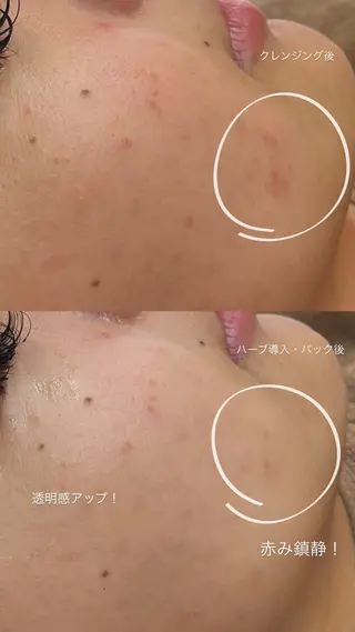 BELLIS HUIT所属・肌質改善｜体質改善ꕤ BELLISHUITのエステ・リラクイメージ