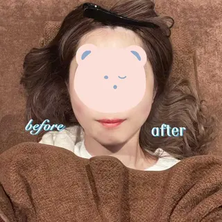 美容鍼灸サロン LOMIHARIのエステ・リラクイメージ