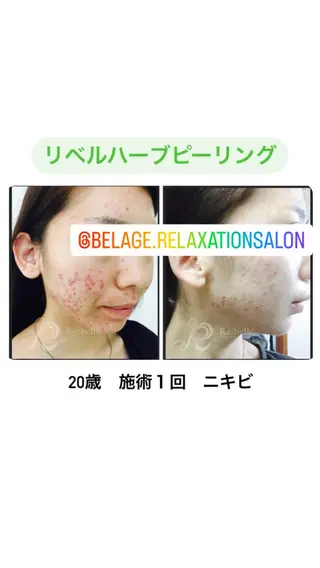 ベラージュ【美背中・ 美尻・フェイシャル】のエステ・リラクイメージ