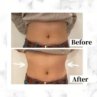 12Dハイフ💗 最強小顔のエステ・リラクイメージ