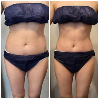 FLEUR大阪・整体 ・ハイフ・痩身・小顔のエステ・リラクイメージ