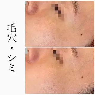 ハーブピーリング専門 BIOEL横浜のエステ・リラクイメージ