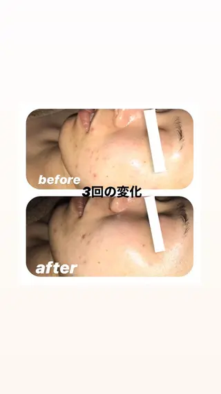 【足圧】鬼👹リンパ 身体整うサロンのエステ・リラクイメージ