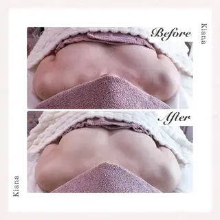 【バスト専門店 】 Kiana のエステ・リラクイメージ