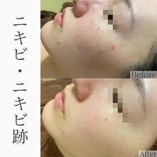 ハーブピーリング専門 BIOEL横浜のエステ・リラクイメージ