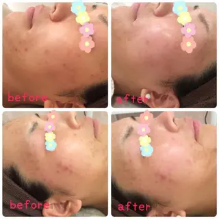 美肌脱毛・ハーブピーリング専門店Larin la beaute所属・Larin la beauteのエステ・リラクイメージ