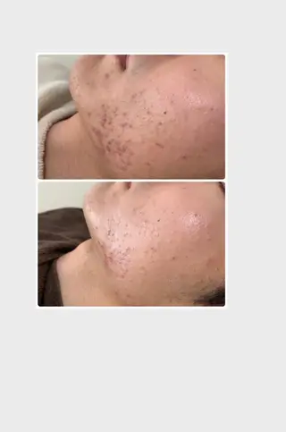 espoir エスポワールのネイルデザイン