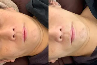 最速小顔・肌質管理 ❣️エスポワールのエステ・リラクイメージ