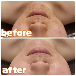 👑Linolaby RAYVIS👑💗のエステ・リラクイメージ