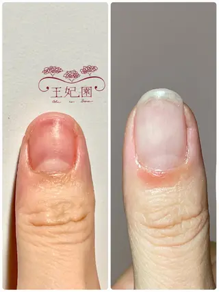 ネイル nail salon王妃の園所属・王妃の園 ohinosonoのネイルデザイン
