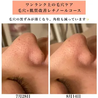 Bellesthe (ベルエステ)のエステ・リラクイメージ