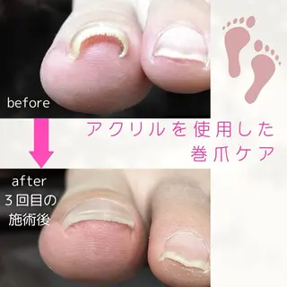 blanca🌺 mayu(東白楽)のマツエク・マツパデザイン