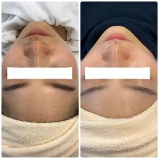 肌質改善美容サロン ému 用賀のエステ・リラクイメージ