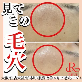 salon  mebell所属・肌管理専門店 mebell天王寺店のエステ・リラクイメージ