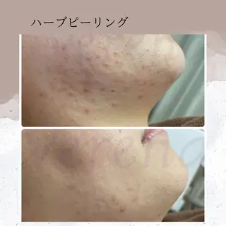 ピーリング専門店 Belluteのエステ・リラクイメージ