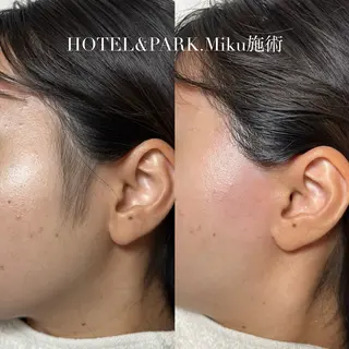 HOTEL&PARK Mikuワックス脱毛のエステ・リラクイメージ